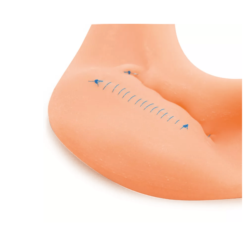 Hohlorgan / Magen - Modell - Erler - Zimmer